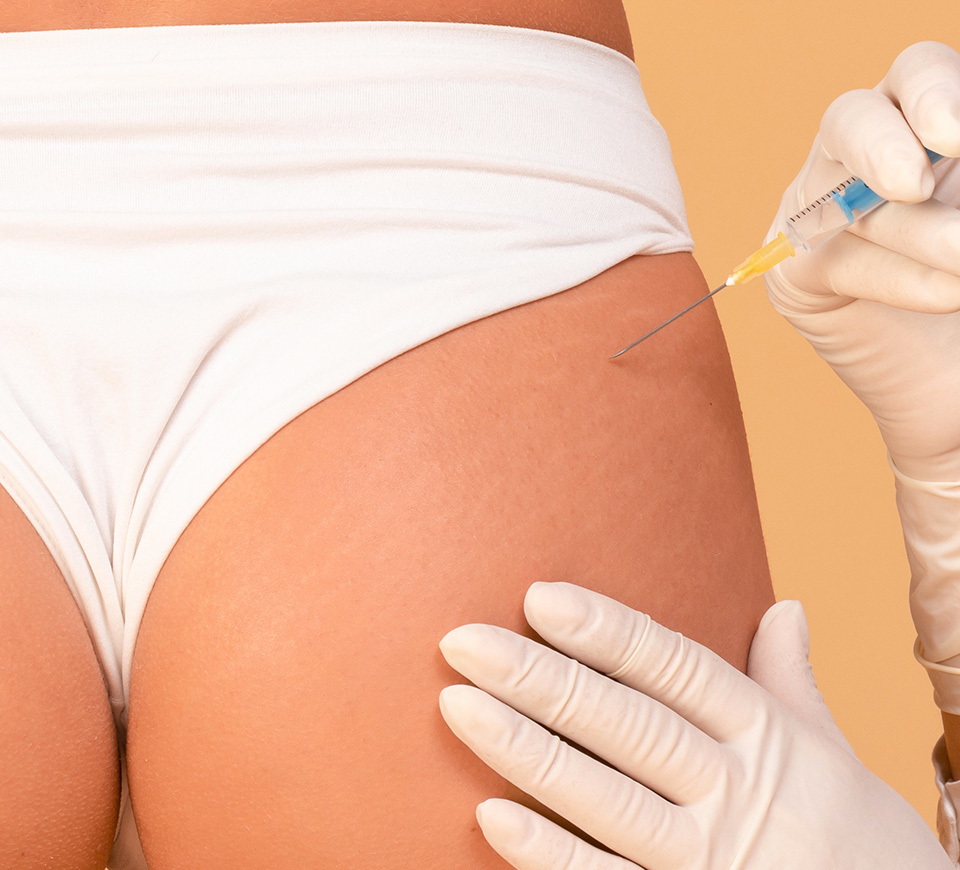 injection fesses