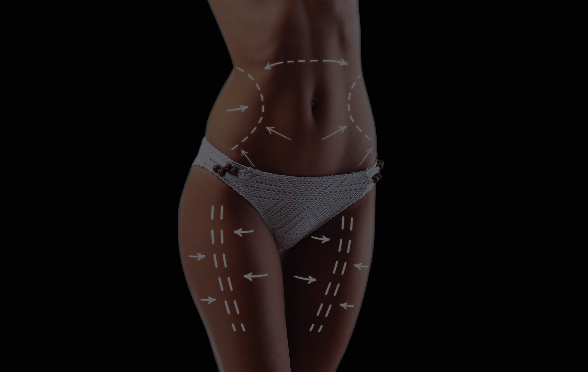 Liposuccion