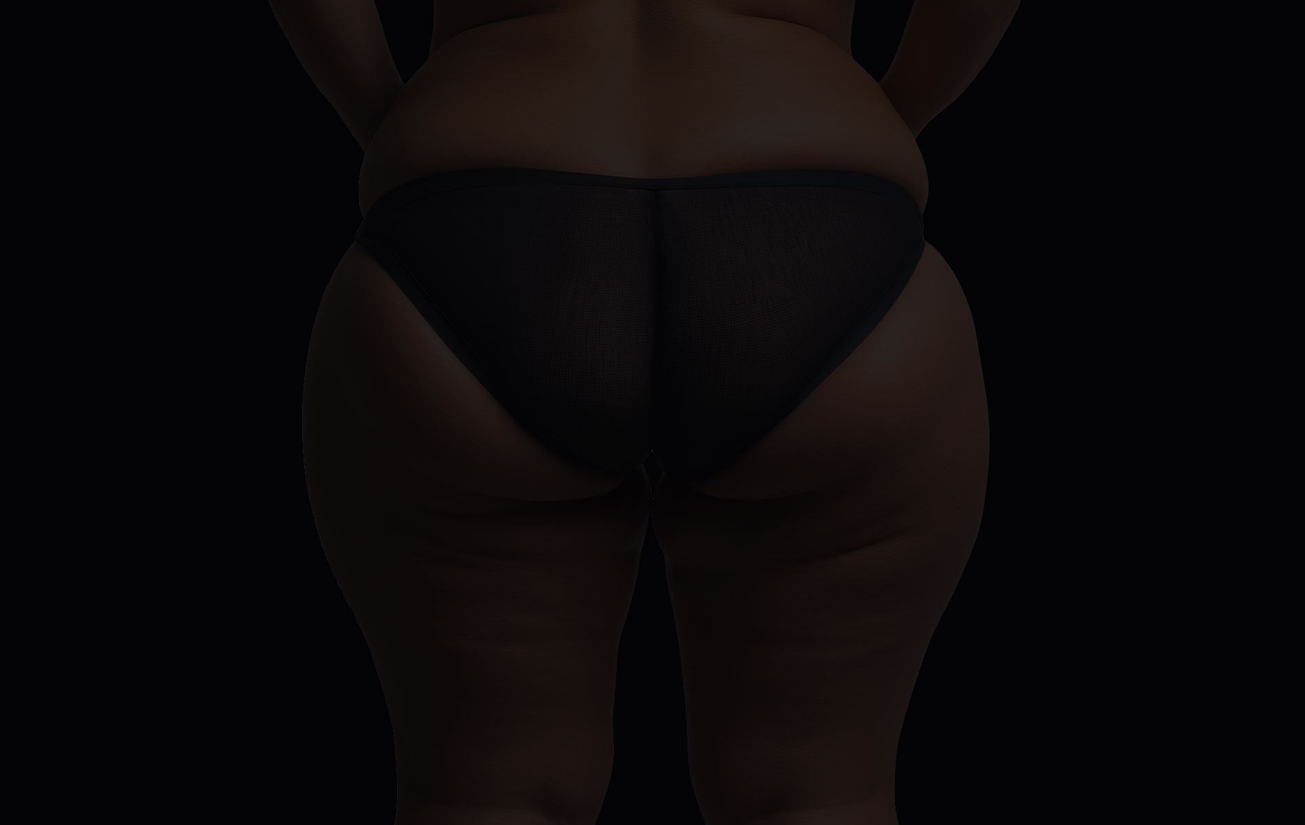 Bodylift inférieur
