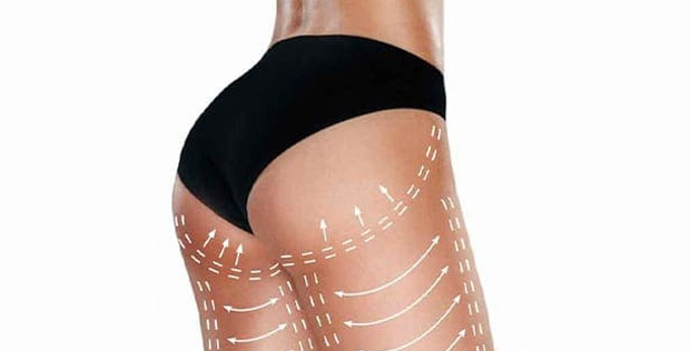 Lipofilling fessier