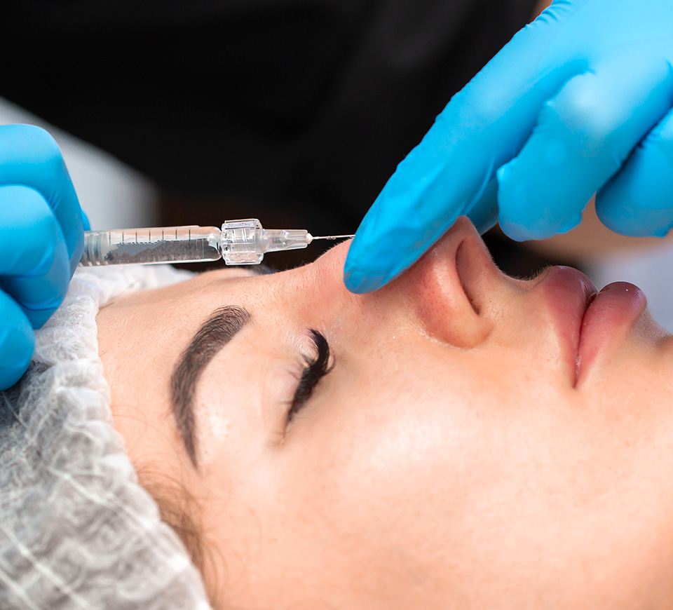 acide hyaluronique rhinoplastie