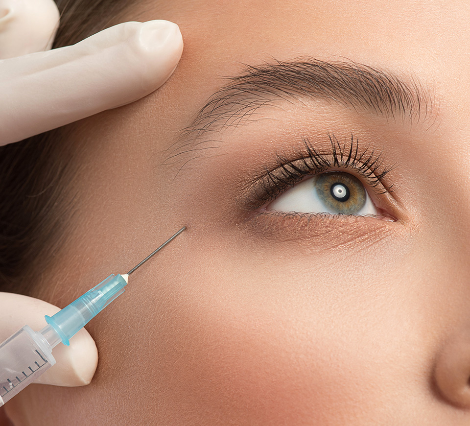 Résultats Injections de botox patte d’oie