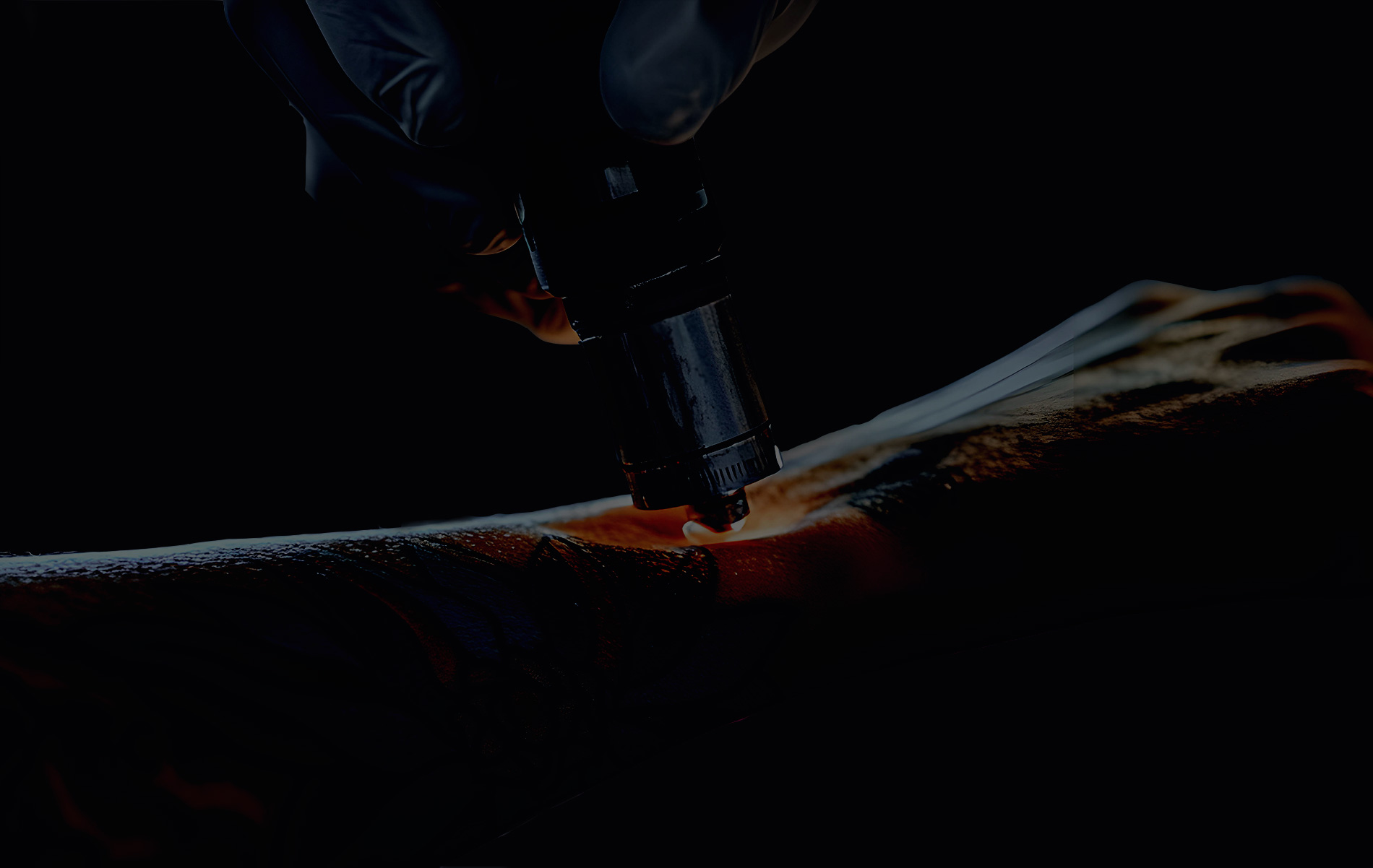 Après le détatouage laser