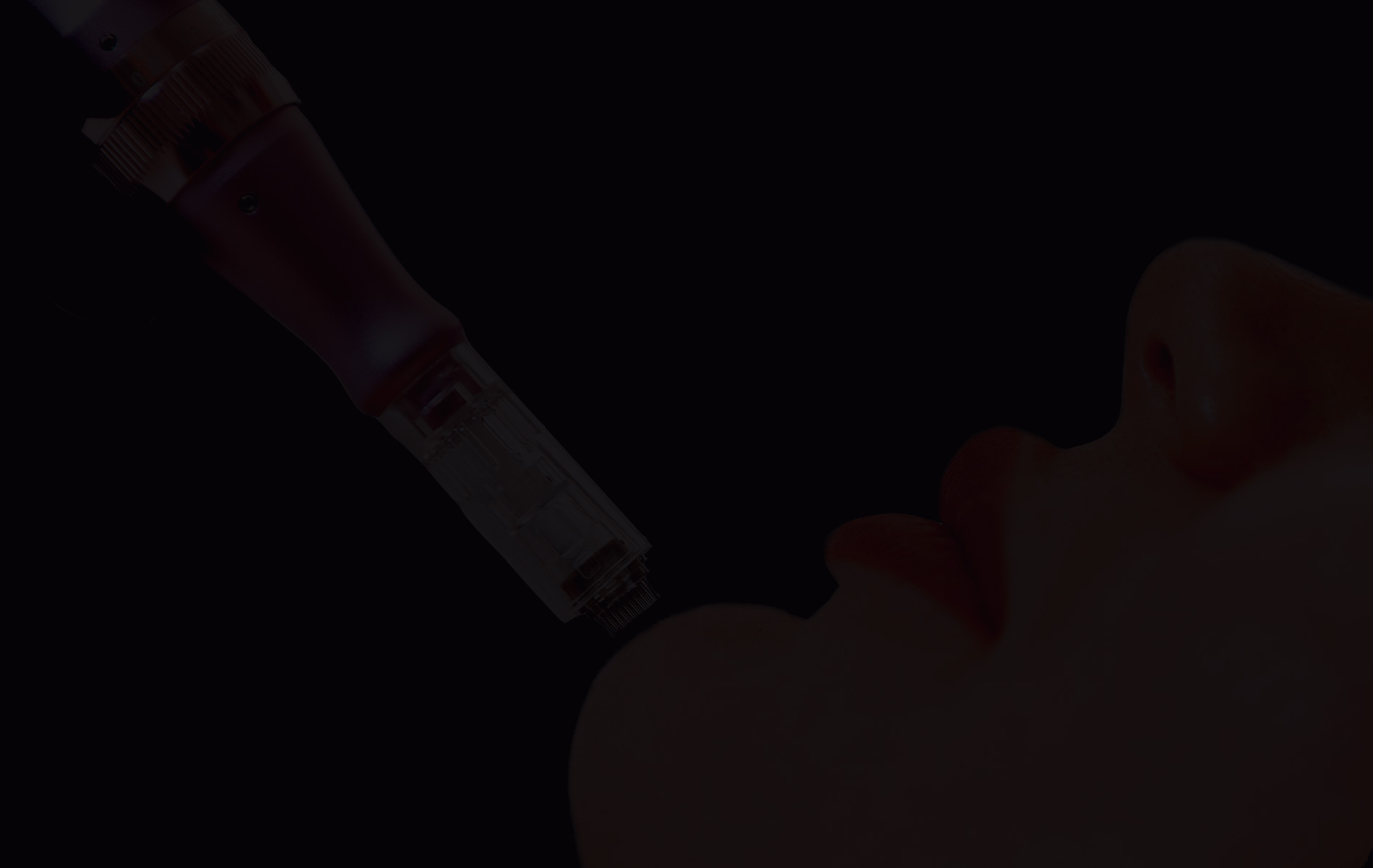 Radiofréquence micro-needling