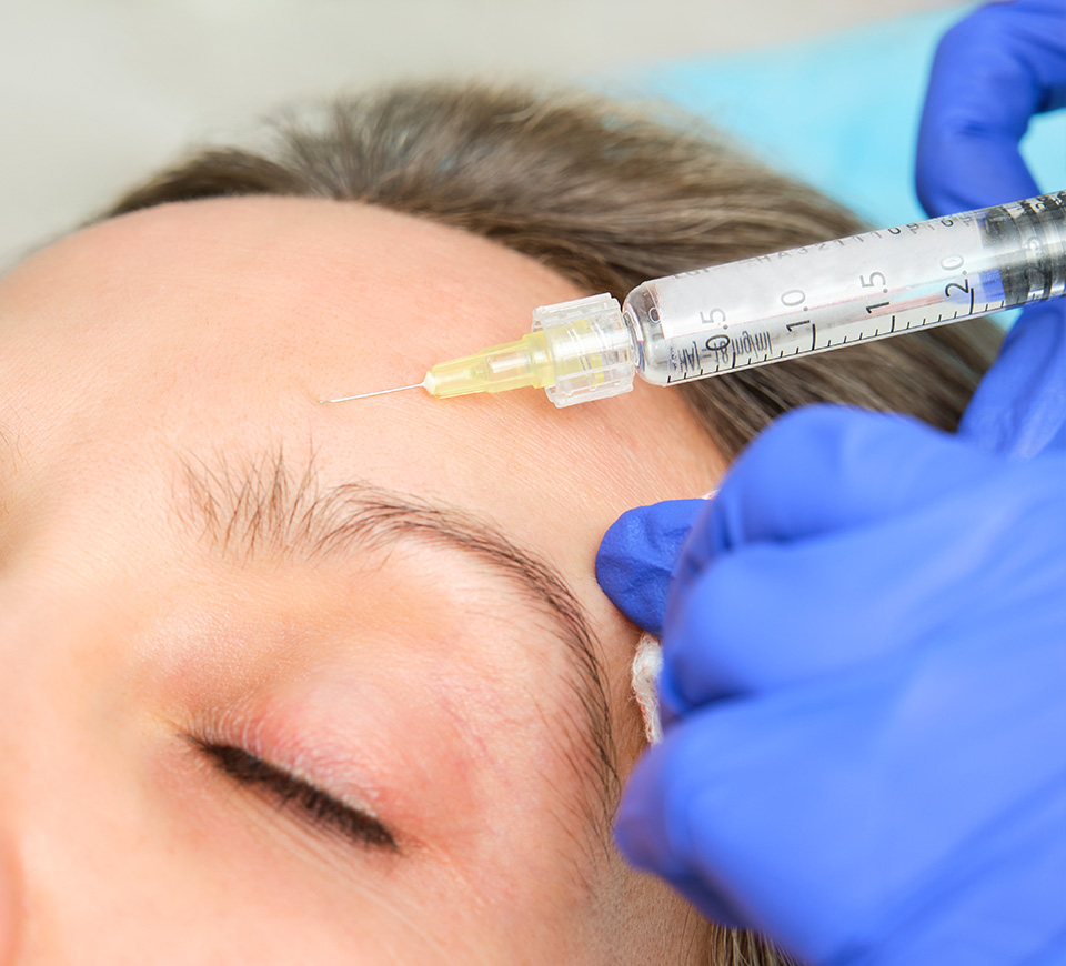 Injections de toxine botulique (botox)