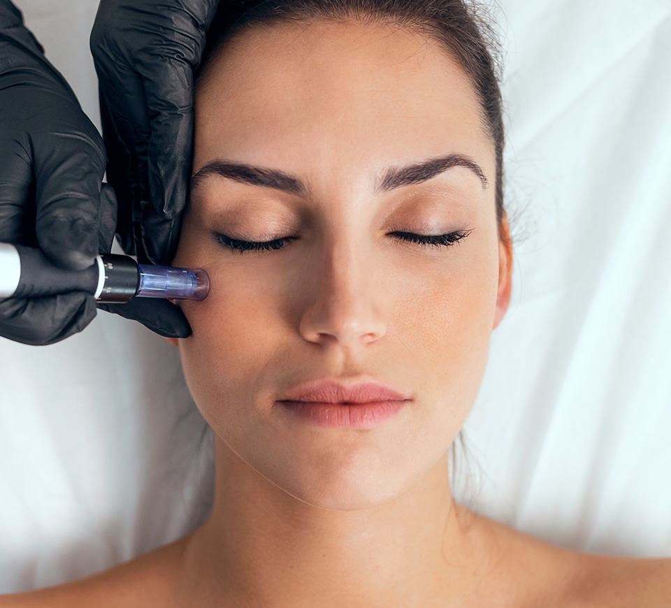suites micro-needling