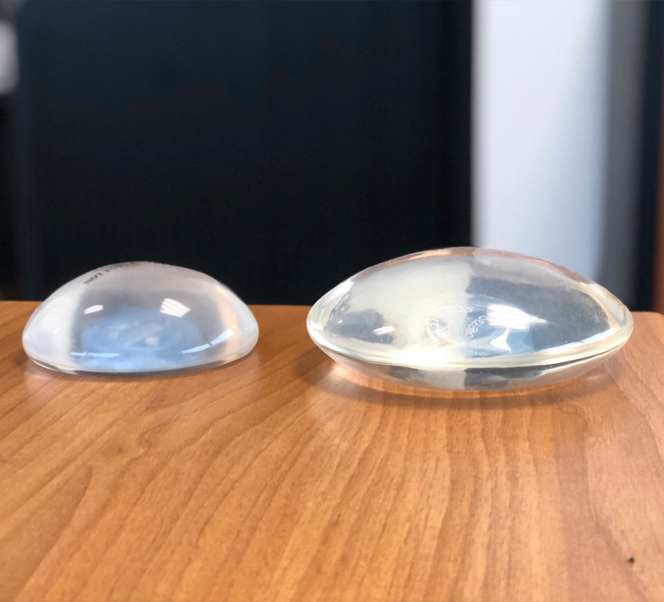 implants fessier