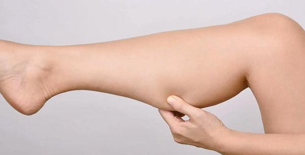 Implant de mollet