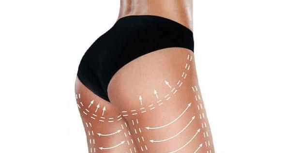 Lipofilling fessier